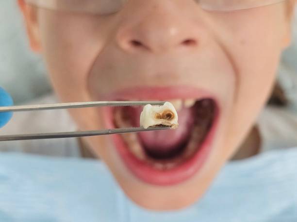 Best Pediatric Emergency Dentist in Rock Hill, MO